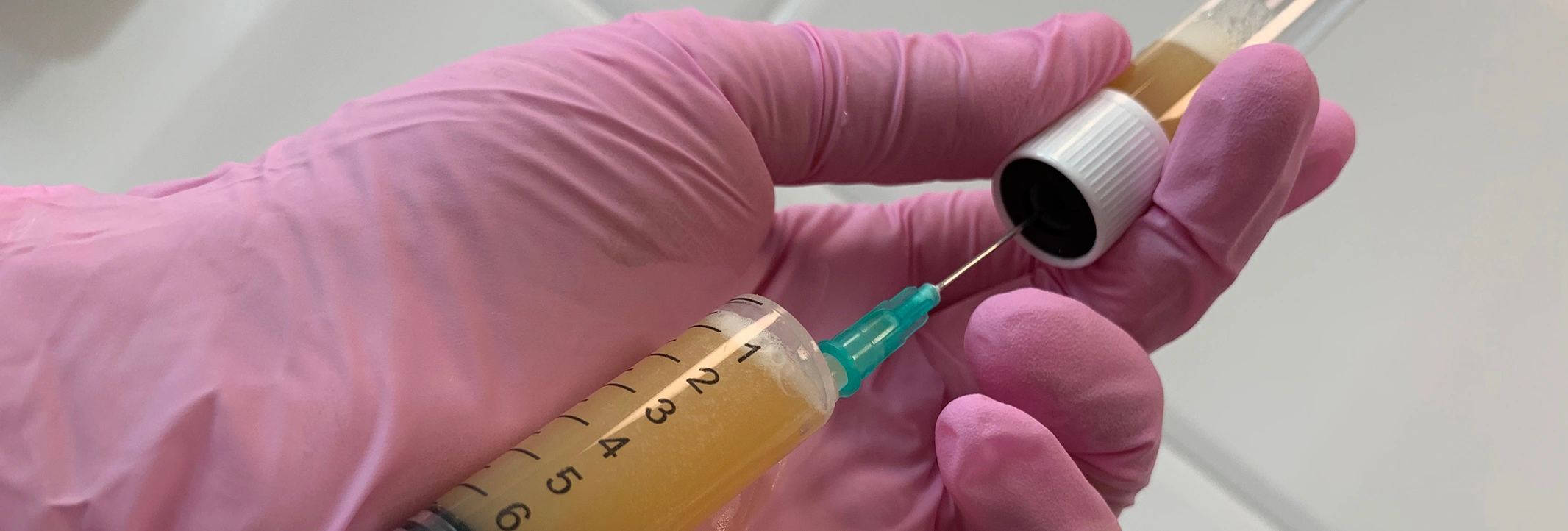 PRP терапия для суставов — регенеративная медицина для восстановления